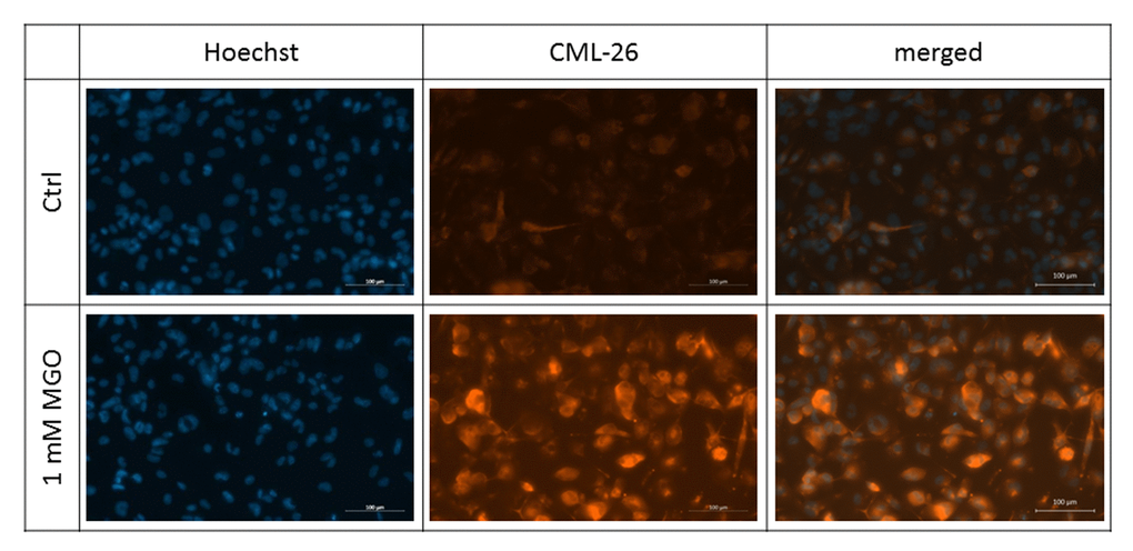 Detection of surface glycation. THP-1 macrophages (M0) were treated with or without 1 mM MGO for 24 h. Immunofluorescence staining of surface glycation was performed using an anti-AGE antibody (CML-26, shown in orange). Hoechst was used as nuclear stain (shown in blue). Shown pictures are representative for 4 independent experiments. Scale bars indicate 100 µm.