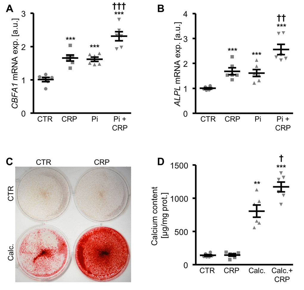 CRP augments phosphate-induced osteo-/chondrogenic transdifferentiation and calcification of HAoSMCs. (A, B) Scatter dot plots and arithmetic means ± SEM (n=6; arbitrary units, a.u.) of CBFA1 (A) and ALPL (B) relative mRNA expression in HAoSMCs treated with control (CTR) or β-glycerophosphate (Pi) without and with 10 µg/ml recombinant human CRP. (C) Representative original images (n=4) showing Alizarin red staining in HAoSMCs treated with control (CTR) or calcification medium (Calc.) without and with 10 µg/ml recombinant human CRP. The calcified areas are shown as red staining. (D) Scatter dot plots and arithmetic means ± SEM (n=6; µg/mg protein) of calcium content in HAoSMCs treated with control (CTR) or calcification medium (Calc.) without and with 10 µg/ml recombinant human CRP. **(p