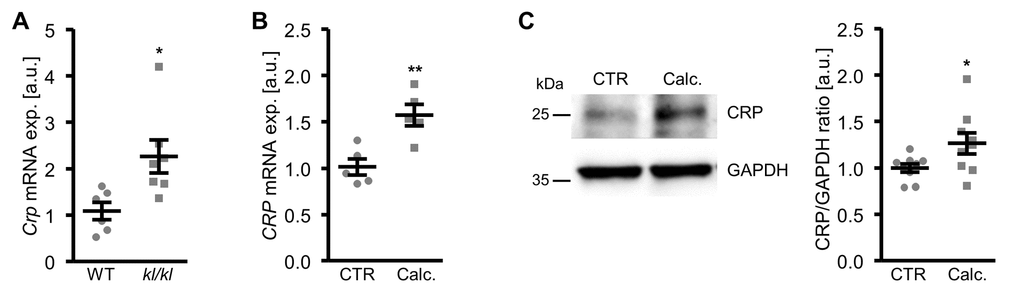 Vascular CRP expression is increased during pro-calcifying conditions. (A) Scatter dot plots and arithmetic means ± SEM (n=6-7; arbitrary units, a.u.) of Crp relative mRNA expression in aortic tissue of klotho-hypomorphic (kl/kl) mice and corresponding wild-type (WT) mice. (B) Scatter dot plots and arithmetic means ± SEM (n=5; a.u.) of CRP relative mRNA expression in HAoSMCs treated with control (CTR) or calcification medium (Calc.). (C) Representative original Western blots and scatter dot plots and arithmetic means ± SEM (n=9; a.u.) of normalized CRP/GAPDH protein ratio in HAoSMCs treated with control (CTR) or calcification medium (Calc.). *(p