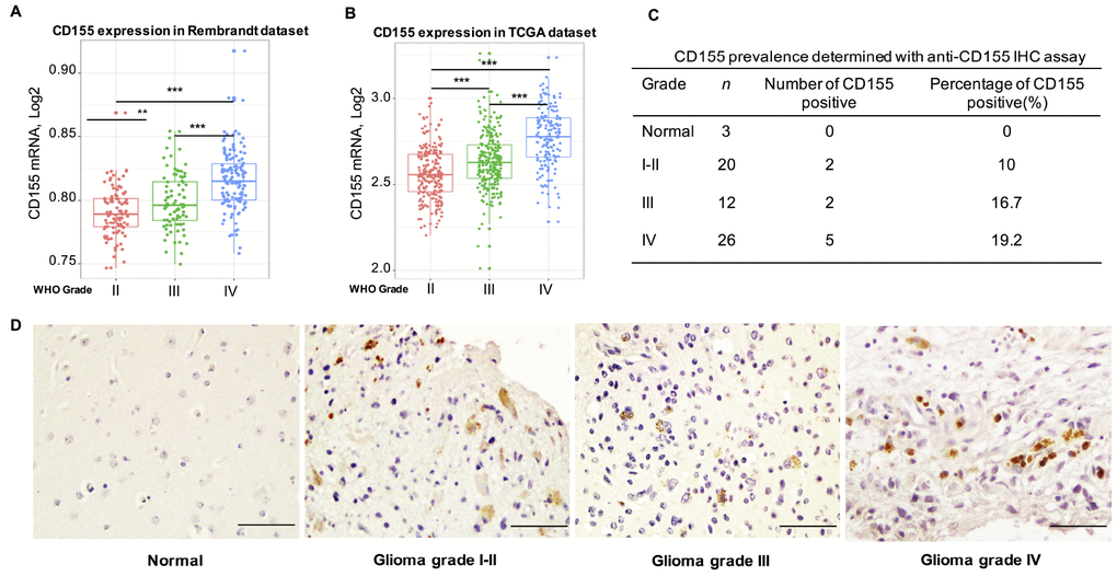 Relationship between CD155 expression and clinical glioma parameters. CD155 transcript levels increase with WHO grade in the Rembrandt dataset (A) and TCGA dataset (B). Protein expression pattern of CD155 in glioma showed CD155 was highly expressed in GBM at protein level (C–D). Glioma tissues of different grades were immunostained for CD155 using anti-CD155 antibody and 3,30-diaminobenzidine (DAB; brown). Haematoxylin was used for nuclear counterstaining (blue). The summarized table included number and percentage of CD155-positive samples out of number of total samples. Scale bars, 100 mm. * indicates p value 