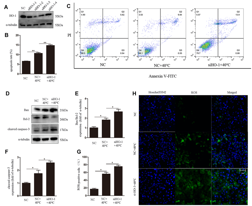 HO-1 gene knockdown enhances ROS generation and induces apoptosis in GCs under heat stress. (A) Western blot analysis of HO-1 expression after siRNA mediated knockdown of HO-1. (B, C) Annexin V/PI FACS analysis of apoptosis. (D–F) Expression of Bax/Bcl-2 and cleaved caspase-3 by western blot. (G, H) Intracellular ROS accumulation detected through DCF fluorescence. Scale bars, 50 μm. Data represent mean ± SEM; n = 3 in each group. *P 