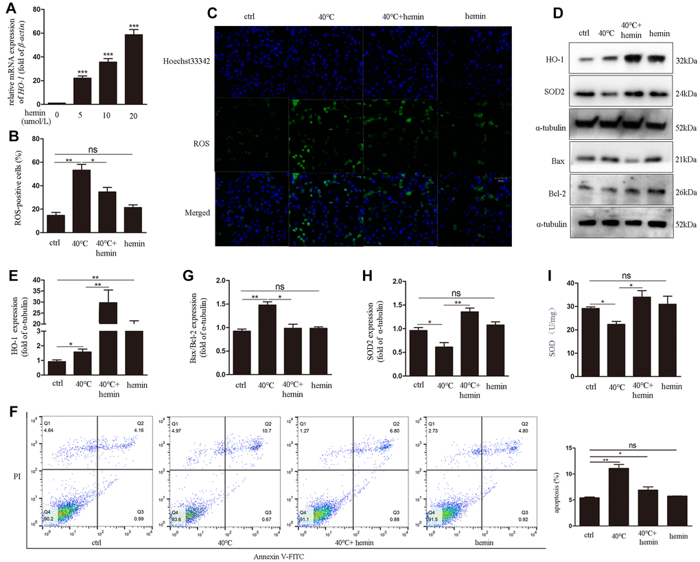 Hemin-mediated HO-1 induction decreases oxidative stress and attenuates ROS generation and apoptosis in GCs exposed to heat stress. (A) qRT-PCR analysis of HO-1 gene expression in GCs pre-treated with hemin (10 μmol/L for 48h). (B, C) Effect of HO-1 overexpression on ROS accumulation in GCs under heat stress. (D, E, G, H) HO-1, SOD2, and Bax/Bcl-2 expression determined by western blotting. (F) Hemin pre-treatment reduced apoptosis of heat-stressed GCs, as determined by FACS assay. (I) Enhanced SOD activity in hemin-treated GCs. Data represent mean ± SEM; n = 3 in each group. *P 