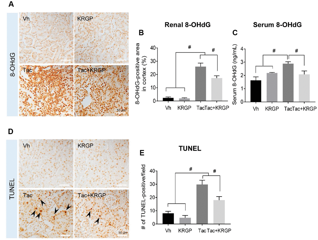 Effect of KRGP administration on Tac-induced the expression of 8-OHdG and TUNEL in a mouse model. (A and B) Representative images and immunohistochemical assay results for 8-OHdG in tissue sections from mouse kidney. (C) 8-OHdG level in mouse serum. (D–E) Representative images and quantification of TUNEL assay in tissue sections from mouse kidney. Bar = 50 μm. Data are presented as mean ± SE. n = 8. #P 