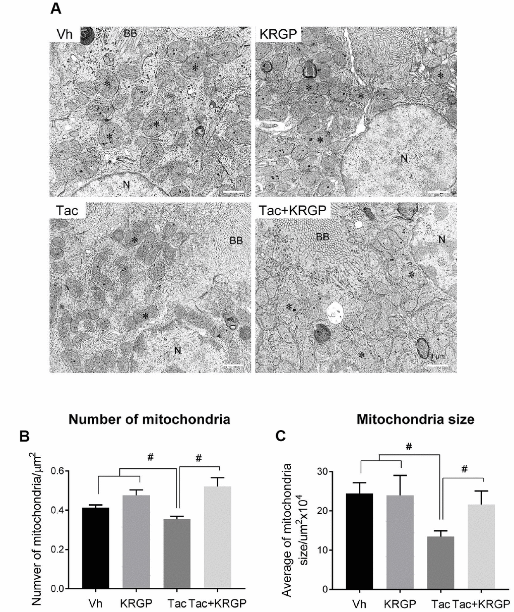 Effect of KRGP administration on Tac-induced mitochondrial ultrastructure in a mouse model. (A) Representative transmission electron micrographs of mitochondrial ultrastructure in the proximal tubules. Asterisks indicate mitochondria. (B and C) Quantitative analysis of number and size of mitochondria. BB, brush border. N, Nucleus. Bar = 1 μm. Data are presented as mean ± SE. n = 8. #P 