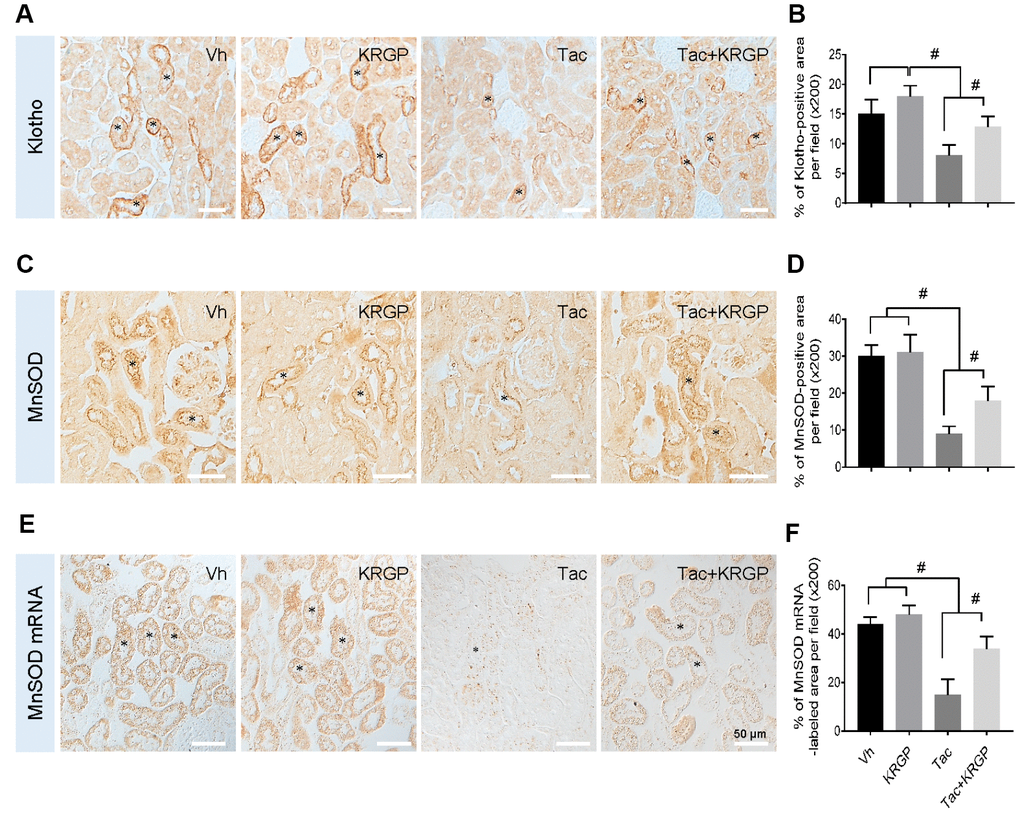 Effect of KRGP administration on Klotho-induced MnSOD signaling pathway in Tac-induced oxidative stress using immunohistochemical analysis in a mouse model. Representative images of immunohistochemical analysis and its quantification for Klotho (A and B) and MnSOD (C and D), as well as in situ hybridization of MnSOD mRNA (E and F) in the tissue sections from mouse kidneys. Asterisks indicate positive renal tubules for Klotho and MnSOD. Bar = 50 μm. #P 