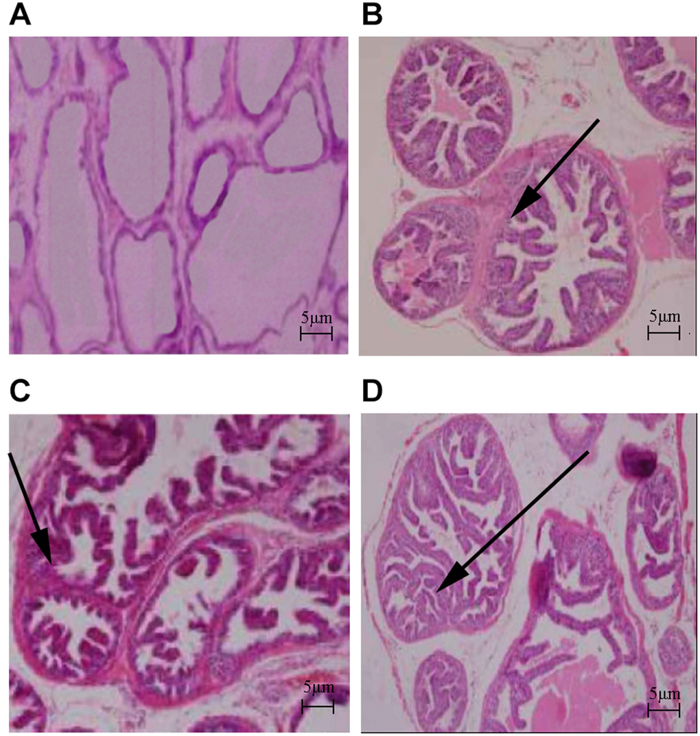 Histologic changes in rat prostate (HE stain, ×40). (A) Control group; (B) HFD group; (C) Testosterone group; (D) HFD+testosterone group.