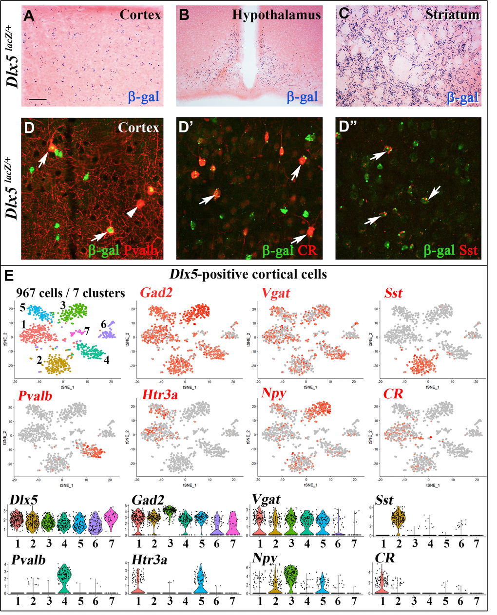 Expression of Dlx5 in adult brain. (A–C) Sections from adult brain of Dlx5lacZ/+ mice. β-D-galactosidase activity, visualized as dark blue dots, is evident in the cortex (A), hypothalamus (B) and striatum (C). (D–D’’) Adult brain somatosensory cortex from Dlx5lacZ/+ mice was double stained with anti-β-D-galactosidase antibodies (green) and antibodies against major GABAergic neuronal subclasses (Parvalbumin (Pvalb), Calretinin (CR) and Somatostatin (Sst)) (red). Arrows point to examples of double-stained neurons; arrowhead indicates a β-D-galactosidase-negative/Pvalb-positive neuron. Bar: 250 μm A-C; 25 μm D, D’’. (E) (Upper panels) t-distributed stochastic neighbor embedding (t-SNE) plots showing the relationship among 967 Dlx5-positive single cells isolated from the frontal cortex. The seven identified clusters are color-coded and expression of selected markers for different classes of cortical GABAergic neurons is presented (Gad2, Vgat, Sst, Pvalb, Htr3a, Npy, CR). All Dlx5-positive clusters are Gad2 and Vgat-positive, all major GABAergic subtypes include Dlx5-positive neurons. (Lower panels) Violin plots showing the normalized expression distribution of selected markers in the different Dlx5-positive clusters.