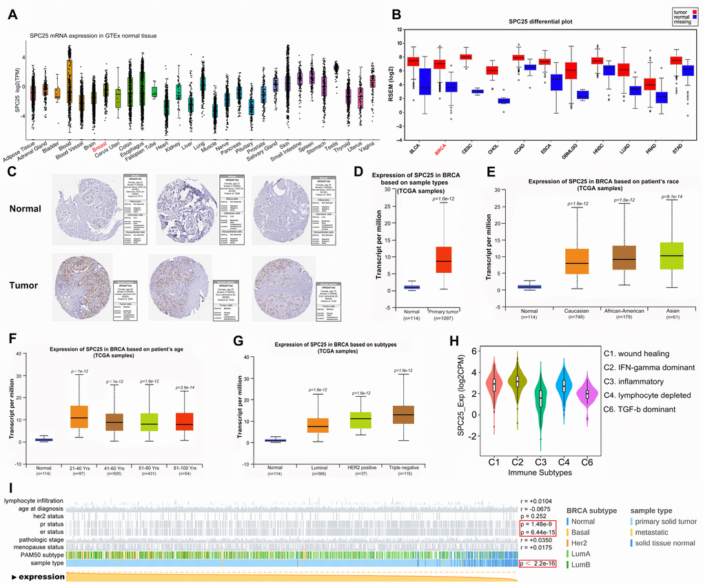 SPC25 expression overview. (A) SPC25 mRNA expression in normal tissues. (B) SPC25 mRNA expression in human cancers is significantly higher than in normal tissues. (C) SPC25 expression in normal breast tissues and BC tissues. (D) SPC25 mRNA expression is significantly higher in BC samples than in normal samples. (E–H) Differences in SPC25 mRNA expression depending on race, age, molecular subtype, and immune subtype. (I) SPC25 mRNA expression is correlated with PR status, ER status, and sample type.