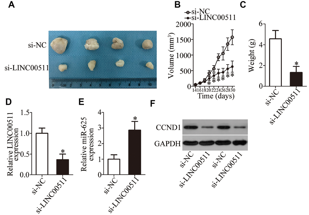 Reduction in LINC00511 expression inhibits ccRCC tumor growth in vivo. (A) Representative images of xenograft tumors derived from si-LINC00511–transfected or si-NC–transfected A498 cells. (B) Tumor volumes in the BALB/c nude mice of si-LINC00511 and si-NC groups were calculated every 2 days and growth curves were generated. *P C) The tumor xenografts in the si-LINC00511 and si-NC groups of BALB/c nude mice were excised and weighed. *P D, E) Expression levels of LINC00511 and miR-625 in xenograft tumors were quantified by RT-qPCR. LINC00511 expression was found to be decreased, while miR-625 expression was high in the xenografts of the si-LINC00511 group compared to the si-NC group. *P F) Protein expression of CCND1 in the xenografts of si-LINC00511 and si-NC groups was determined by western blotting.