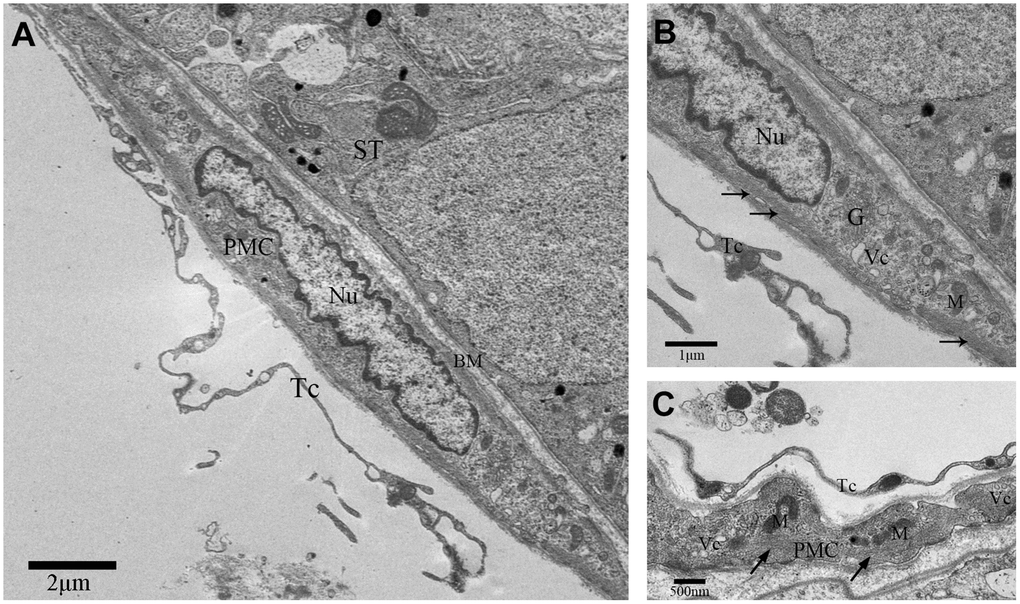 TEM photograph of a peritubular myoid cell in the rat testis. (A) Peritubular myoid cells are seen in the lamina propria of the seminiferous tubule. (B–C) A single peritubular myoid cell (PMC) is shown with actin filaments (indicated by the arrow), mitochondria, Golgi apparatus and secretory vesicles. Note: PMC: peritubular myoid cell; ST: seminiferous tubule; TC: telocyte; BM: basement membrane; Nu: nucleus; M: Mitochondria; G: Golgi apparatus;Vc: Vesicles. Scale Bar = A: 2μm; B: 1μm and C: 500nm.