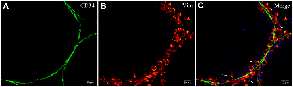 Double immunofluorescence staining of telocytes in rat testis with anti-CD34 and anti-vimentin antibodies. (A–C) Immunofluorscence staining shows that CD34 (green) and Vimentin (red) do not co-localize around the seminiferous tubule. Vimentin is expressed on Sertoli cells (pointed by arrows) and Leydig cells (pointed by triangles). Scale Bar = A–C: 20μm.