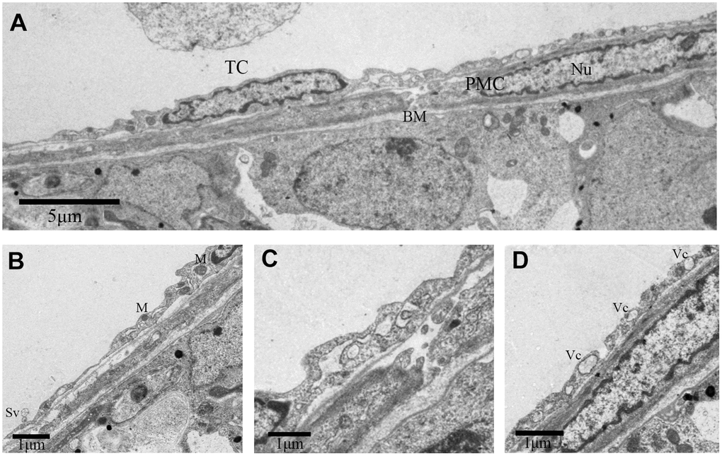 TEM photograph of a telocyte in rat testis. (A) Telocyte overlays the peritubular myoid cell in the lamina propria of seminiferous tubule. (B, D) Cytoplasmic process shows long extensions with (B) mitochondria and (D) vesicles. (C) The telopode seems more developed, with winding, thickened and dichotomous feature. TC: Telocyte; PMC: Peritubular myoid cell; Bm: Basement membrane; Nu: Nucleus; M: Mitochondria; Sv: Secretory vesicle; Vc: Vesicles. Scale Bar = A: 5μm, B–D:1μm.
