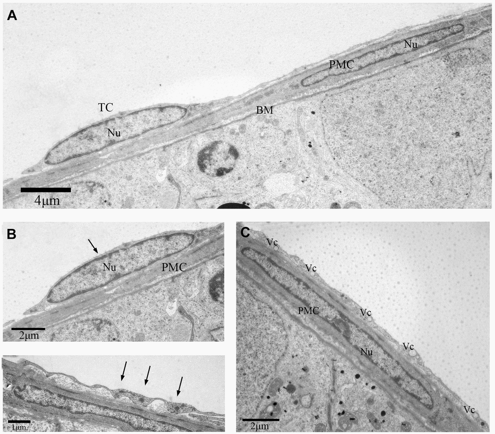 TEM photograph of another telocyte in the rat testis. (A) The telocyte surrounds the seminiferous tubule and the peritubular myoid cell.(B) The telocyte shows distinctly elongated nucleus (indicated by the arrow) with a small amount cytoplasm. (C) The cytoplasmic process shows few attachment plaques (indicated by the arrows). (D) The cytoplasmic prolongation shows many vesicles. TC: Telocyte; PMC: Peritubular myoid cell; Nu: Nucleus; Bm: Basement membrane; Vc: Vesicles. Scale Bar = A: 4μm; B:2μm; C: 1μm; D: 2μm.