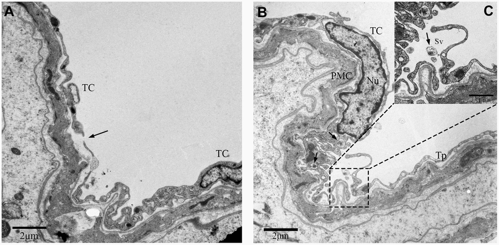 TEM photograph showing two neighboring telocytes in the rat testes. (A) Telopodes (Tps; indicated by arrow) and (B) small secretory vesicles (indicated by the arrows) of the two telocytes are shown.(C) Higher magnified image shows the area between the two telocytes. Note: TC: Telocyte; PMC: Peritubular myoid cells; Nu: Nucleus; Tps: Telopode; Sv: Secretory vesicle. Scale Bar = A–B: 2μm.