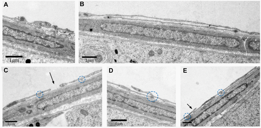 TEM photograph shows different types of junctions formed by Tps with other cells in the rat testis. Physical contacts made by Tps with adjacent cells through (A) Mortise and tenon joint, (B) long overlapped structure, (C) closeness (indicated by the arrow), (D, E) short overlapped structure and punctate contact (indicated by the circles). Scale Bar = A–D: 1μm; E: 10μm.