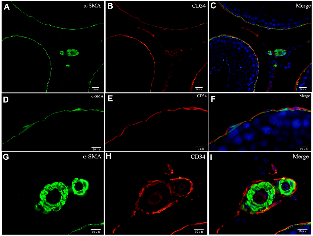 Double immunofluorescence of telocytes in the rat testis with anti-αSMA and anti-CD34 antibodies. (A–F) Immunofluorescence staining shows positive αSMA (A; green) and CD34 (B; red) staining of the inner and the outer layers surrounding the seminiferous tubules. (G–I) Immunofluorescence staining shows positive CD34 staining (red) around the blood vessel and in endothelial cells, and positive αSMA staining (green) on the vessel wall. Scale Bar = A–C: 20μm; D–I: 10μm.