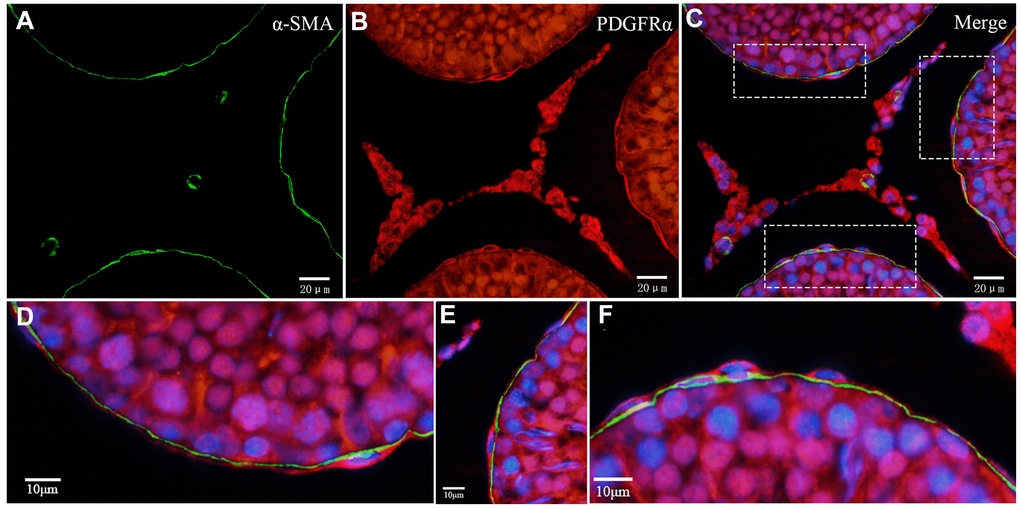 Double immunofluorescence staining of telocytes in the rat testis with anti-αSMA and anti-PDGFRα antibodies. (A–C) Immunofluorescence images show positive αSMA (green) and PDGFRα (red) staining inside/outside as continuous layers around the seminiferous tubule. (D–F) Immunofluorescence images show higher magnification illustrates the rectangular area in (C). Scale Bar = A–C: 20μm; D–F:10μm.