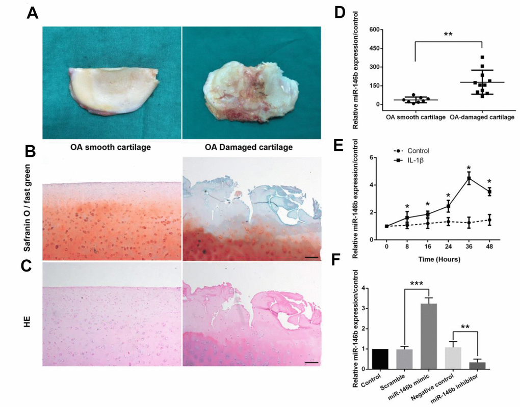 miR-146b expression is up-regulated in OA-damaged cartilage tissues and in IL-1β-stimulated mouse chondrocytes. (A) Representative macromorphological images of smooth cartilage and damaged cartilage from OA patients. (B, C) Safranin O-fast green and H&E staining of smooth OA cartilage and damaged OA cartilage. Scale bar: 100μm. (D) The expression level of miR-146b in smooth and damaged cartilage tissues. (E) Time course of the miR-146b expression under IL-1β stimulation in mouse chondrocytes. (F) mRNA level of miR-146b in mouse chondrocytes transfected with miR-146b-mimic and miR-146b-inhibitor were evaluated by qRT-PCR. The negative control of miR-146b mimic and miR-146b inhibitor were referred as to scramble and NC. *PPP