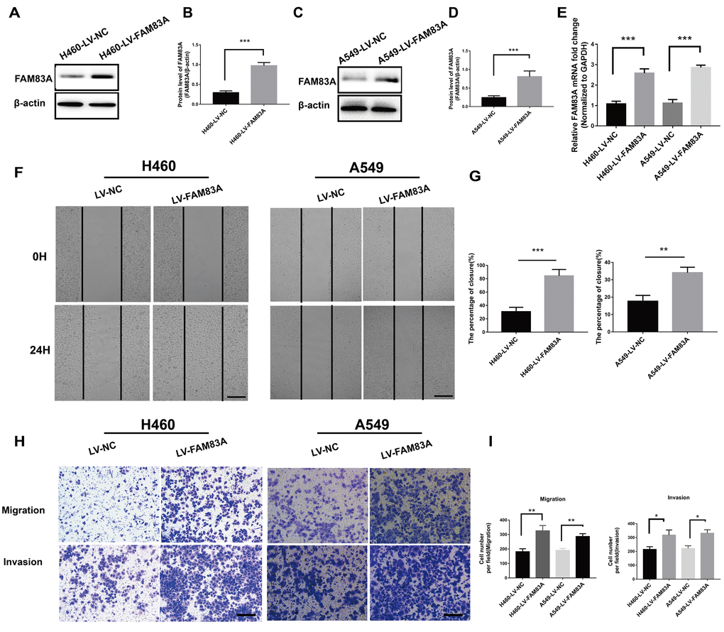 Overexpression of FAM83A facilitated NSCLC cell migration and invasion capacity in vitro. H460 and A549 cells were transduced with a FAM83A lentivirus (LV-FAM83A) or a control lentivirus (LV-NC). (A–E) Overexpression of FAM83A in H460 and A549 cells was confirmed at both the protein (A–D) and RNA (E) levels. (F–G) H460 and A549 cells transduced with the FAM83A lentivirus were subjected to a wound-healing assay. Images were taken at 0 h and 24 h. (H–I) Transwell assays assessed tumor cell migration and invasion capacity. Scale bar, 200 μm. Error bars: mean ± SD (n=3). *p