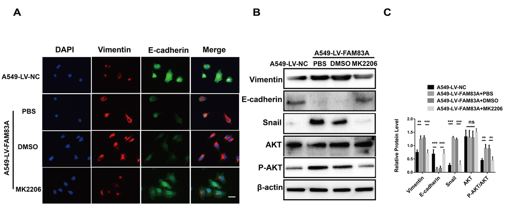 Inhibition of AKT impaired the EMT phenotype owing to FAM83A overexpression. (A) Immunofluorescence of Vimentin and E-cadherin in FAM83A-transfected A549 cells with or without MK2206. The nucleus was counterstained with DAPI. The fourth panel of each shows the merged image of the previous panels. (B–C) Protein levels of Vimentin, E-cadherin, Snail, AKT and P-AKT (p-S473) were detected by Western blot in stable A549-LV-NC and A549-LV-FAM83A cells (with or without MK2206). Scale bar, 100 μm. Error bars: mean ± SD (n=3). NS, no significant, *p