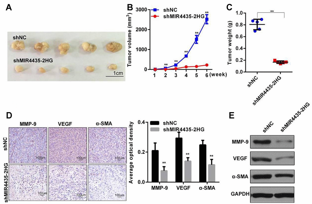 MIR4435-2HG promotes gastric cancer cell tumorigenesis in vivo. (A) MIR4435-2HG knockdown inhibited subcutaneous tumor formation in nude mouse models. Compared to the HGC-27/shNC group, the HGC-27/shMIR4435-2HG group showed smaller tumor sizes (n=5). (B) Quantitative comparison was made between the shNC and shMIR4435-2HG groups at weekly intervals using t-tests. Data are means ± SD for five samples (**P C) Individual tumor weights from mice in the two groups (**P D) Expression of N-Cadherin, MMP-9, VEGF and α-SMA in the two groups was detected using IHC. (E) Expression of MMP-9, VEGF and α-SMA in two groups were detected by WB and quantitated (**P 