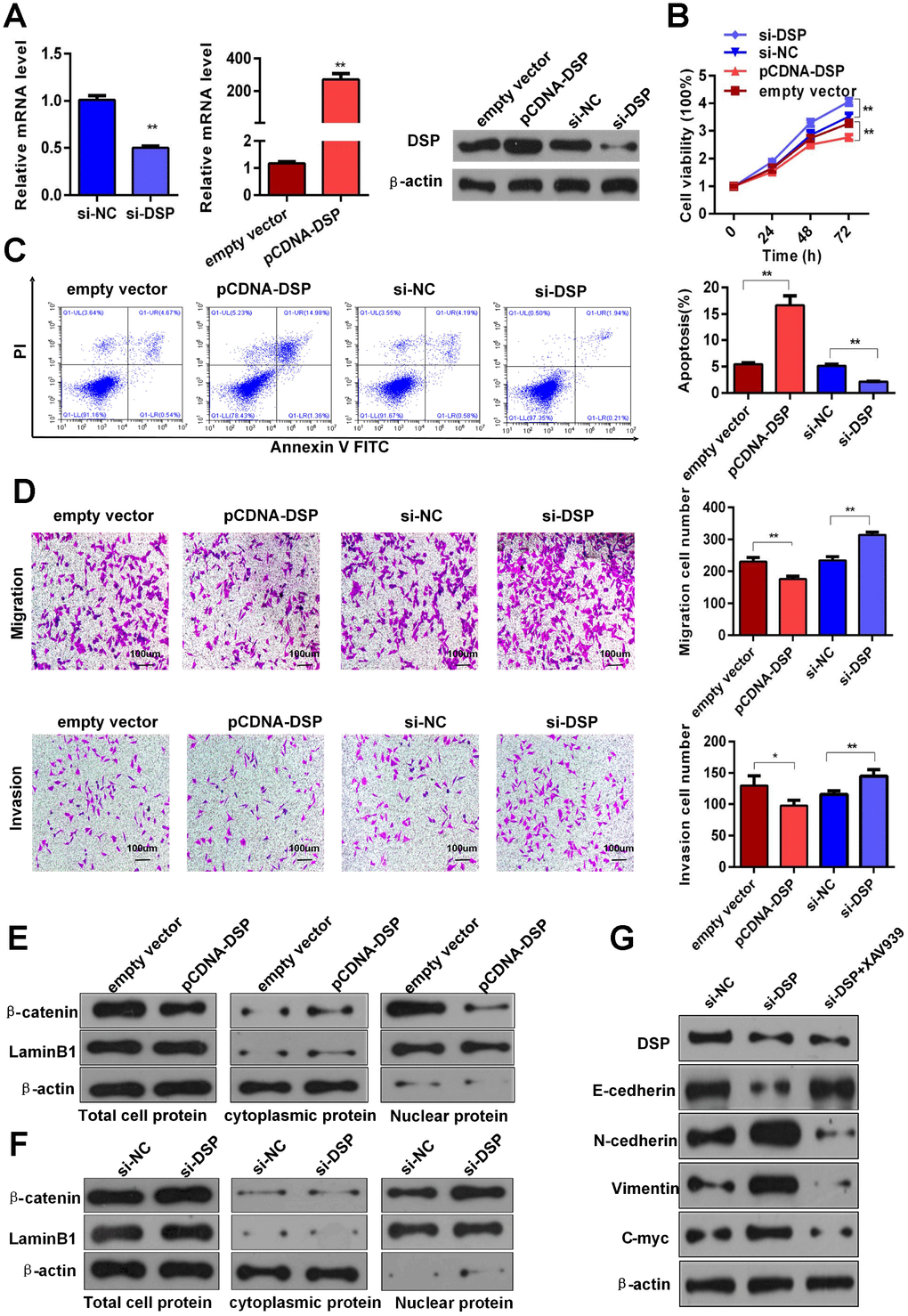 DSP inhibits GC growth and metastasis via Wnt/β-catenin signaling. (A) Depletion and overexpression of DSP were verified using RT-qPCR and WB. (B) CCK8 assays were performed after knockdown and overexpression of DSP (**P C) Flow cytometric apoptosis assays were used to assess cell apoptosis after silencing and overexpression of DSP (**P D) Transwell assays were used to determine the invasiveness of cells with down-regulated and up-regulated DSP (*P **P E–F) Total, cytoplasmic and nuclear levels of β-catenin and lamin B1 were detected by WB after promoting or inhibiting DSP expression. (G) Expression levels of E-cadherin, N-cadherin, vimentin and c-myc were determined using WB after DSP knockdown or combined treatment with DSP siRNA and a Wnt/β-catenin inhibitor (XAV939a).