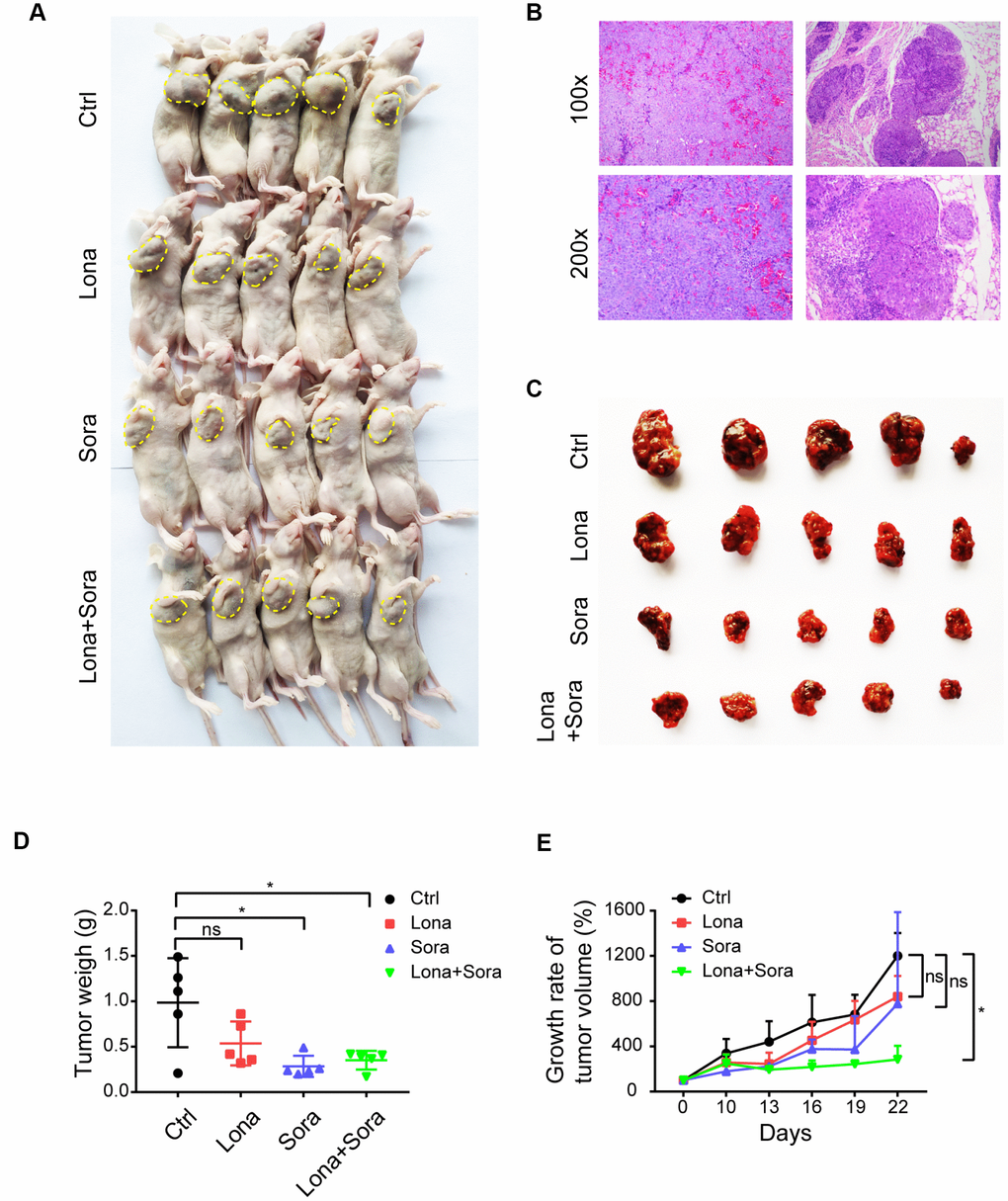 Co-treatment of lonafarnib and sorafenib suppresses HCC cell growth in vivo. (A) All mice used in the xenograft experiment were shown. The yellow dashed line depicts the border of palpable xenograft tumors. (B) Hematoxylin and eosin (H and E) staining of one xenograft tumor. (C) Isolated tumors from nude mice at the experimental endpoint. (D–E) Weights (D) and growth curves (E) of xenograft tumors from nude mice at the experimental endpoint. ns, P > 0.05; *P 