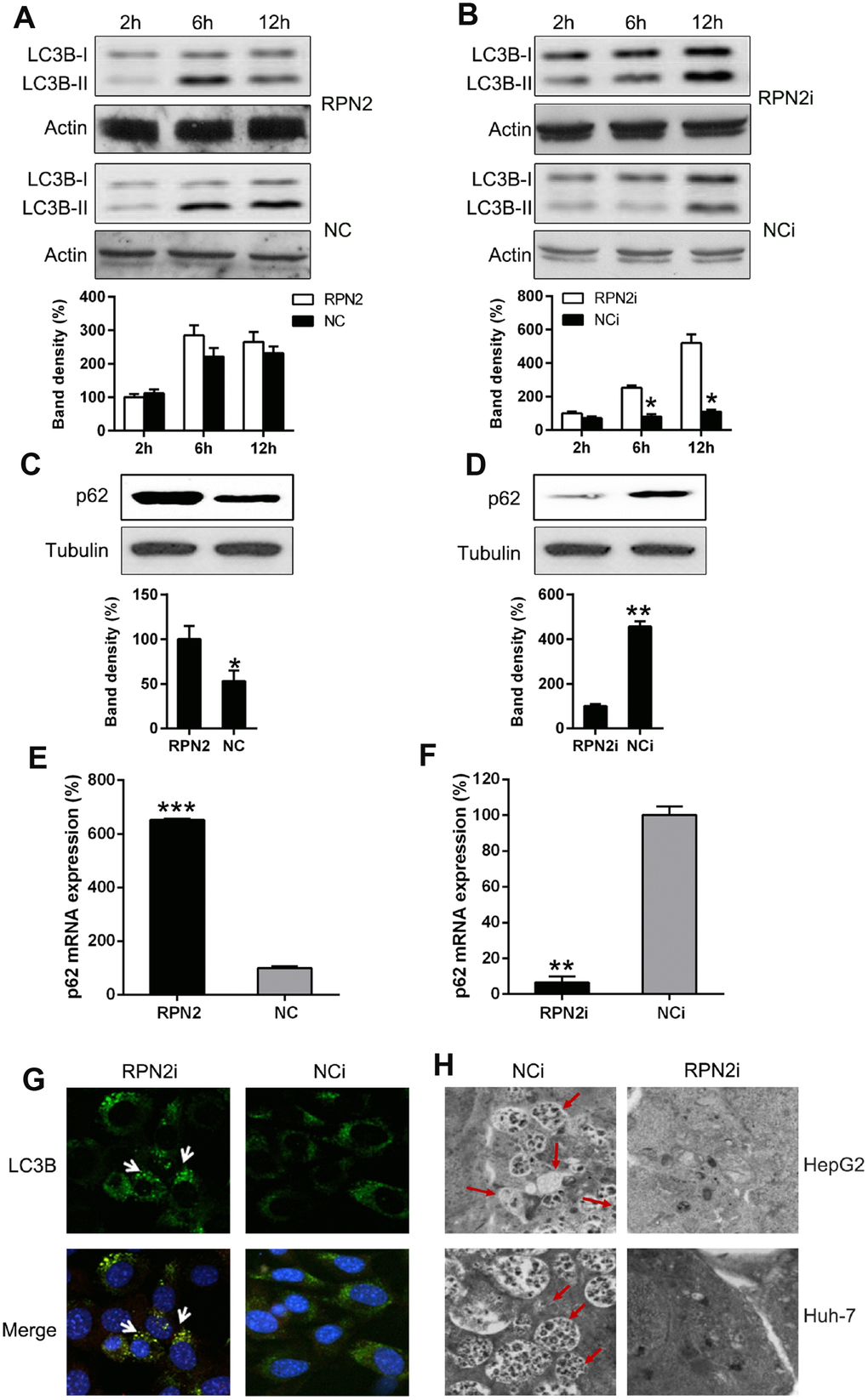 RPN2 depletion leads to autophagy. Cells were firstly serum-starved for 24 hr. Then cells were treated with the solvent (DMSO) or 10 nM 3-Methyladenine (3-MA) for the indicated time before harvesting. (A, B) HepG2 cells were seeded onto 12-well plates, kept overnight and then starved for one day. Cells were infected with AD-RPN2 or transfected with shRNA-RPN2, and were serum-starved for 24 hr. Then cells were treated with the solvent (DMSO) or 10 nM 3-Methyladenine (3-MA) for the indicated time before harvesting. Whole cellular proteins were subjected to WB to indicate dynamic of LC3B Western blot analysis then determined the expression level of (C, D) p62 in cells with RPN2 overexpression and RPN2 silencing. (E, F) qPCR assay analyzed mRNA expression of p62 during RNP2 overexpression and silencing, respectively. (G) HepG2 cells were co-transfected with the shRNAs and GFP-LC3, as indicated, for 2 days. Cellular location of GFP-LC3B was then observed by IFA (magnification: 400x). (H) Autophagesomes were shown by transmission electron microscopy. Electron microscopy images of autophagic vacuoles in HepG2 and Huh-7 cells with silenced RPN2 or controls. Red arrows illustrate some of the autophagic vacuoles at different stages of the autophagy process (magnification: 2000x). The band of target protein was normalized to the density of action. The quantification was performed independently in a single band. The experiments were performed three times. Data were recorded as mean ± SD. **P P 