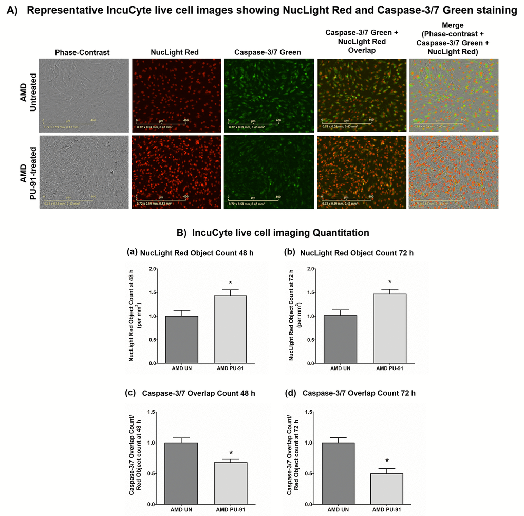 PU-91 regulates apoptotic cell death – Caspase-3/7 staining. (A) Shows representative IncuCyte live-cell images of untreated (AMD UN) and PU-91-treated AMD cybrid cells (AMD PU-91) stained with NucLight Red and Caspase-3/7 Green reagent. (B) Shows quantitation graphs for the 48 h and 72 h time points. Data are presented as mean ± SEM and normalized to untreated (UN) AMD cybrids which were assigned a value of 1. Mann-Whitney test was used to measure statistical differences; *p≤0.05.