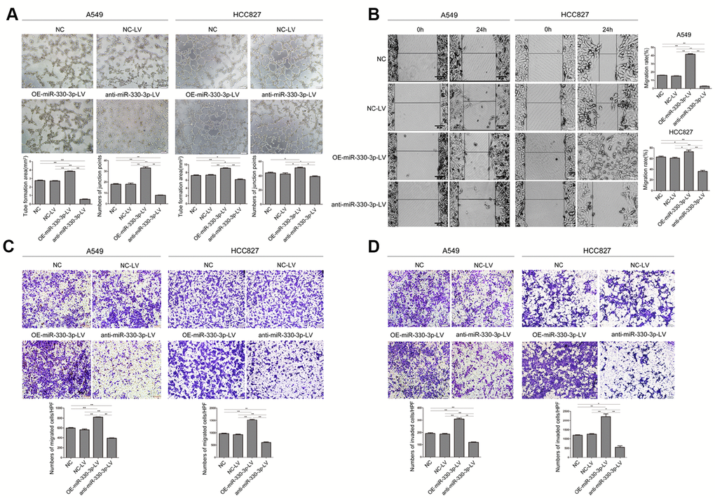 MiR-330-3p promoted tube formation, cell migration and invasion in A549 and HCC827 cells. (A) Tube formation assay measuring proangiogenic activity in A549 and HCC827 cells; tube formation was assessed using an inverted light microscope (Olympus IX71, original magnification ×100). (B) Wound-healing assays were performed to assess NSCLC cell migration. Wound closure was determined 24 h after the scratch. (C) Transwell migration assay measuring NSCLC cell migration in A549 and HCC827 cells stably transfected with NC-LV, OE-miR-330-3p-LV or anti-miR-330-3p-LV, respectively. (D) Transwell invasion assay was used to quantify cell invasion in a Matrigel-coated chamber. The average number of cells migrating per field of view in three different experiments is plotted. *P P 