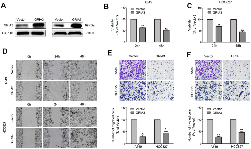 Effects of GRIA3 overexpression on NSCLC cell viability, migration and invasion in vitro. (A) GRIA3 protein expression by western blotting after transfection with GRIA3 or vector. (B) Representative images of the MTT assay of A549 and HCC827 cells transfected with GRIA3 or vector. (C) Representative images of the wound healing assay of A549 and HCC827 cells transfected with GRIA3 or vector. (D, E) Representative images (upper) and quantification (lower) of the Transwell migration assay (D) and Transwell invasion assay (E) of A549 and HCC827 cells transfected with GRIA3 or vector. Values are mean ± SD, *P P 
