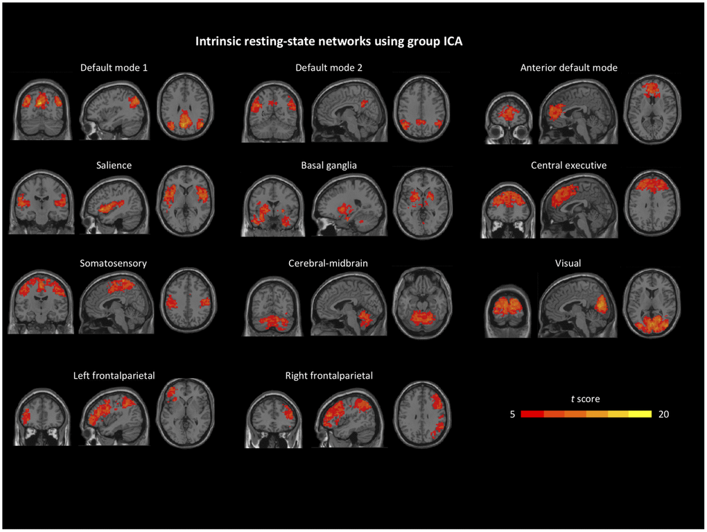 Identified intrinsic resting-state network components from group independent component analysis. Details can be found in the Group ICA section.