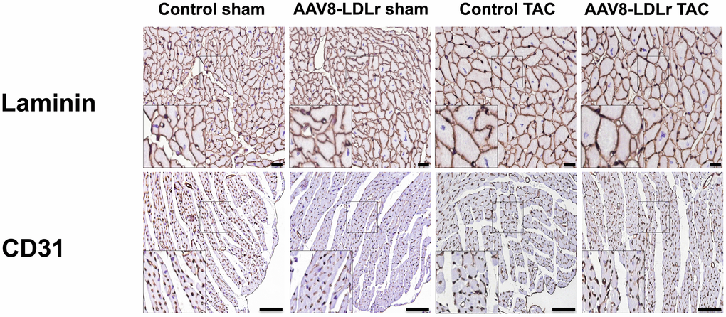 Immunohistochemical analysis of the myocardium of sham mice and TAC mice at day 56 after operation. Representative photomicrographs show laminin-stained cardiomyocytes and CD31-positive capillaries. Scale bar represents 50 μm.