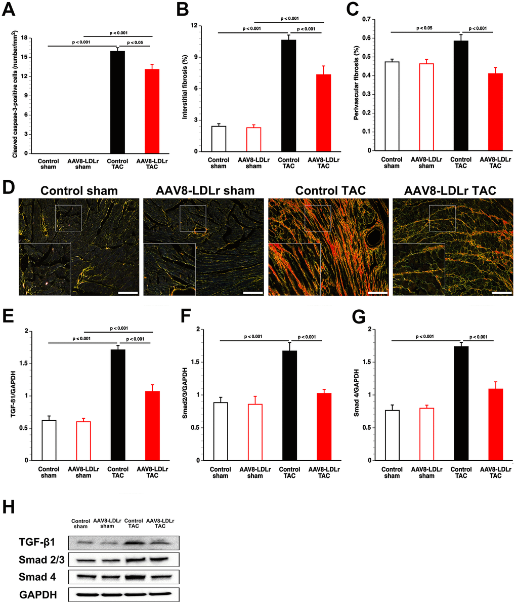 AAV8-LDLr gene transfer significantly reduces interstitial fibrosis, perivascular fibrosis, and apoptosis after TAC. Bar graphs illustrating the number of cleaved caspase-3 positive cells (A), the degree of interstitial fibrosis (B), and the degree of perivascular fibrosis (C) in control sham (n=14), AAV8-LDLr sham (n=11), control TAC (n=25), and AAV8-LDLr TAC (n=11) 8 weeks after operation. Representative photomicrographs showing Sirius Red-stained interstitial collagen viewed under polarized light (D). Scale bar represents 50 μm. Bar graphs illustrating the 25 kD isoform of TGF-ß1 (E), Smad2/3 (F), and Smad4 (G) myocardial protein levels quantified by western blot in the myocardium of control sham (n=8), AAV8-LDLr sham (n=8), control TAC (n=8), and AAV8-LDLr TAC (n=8) mice 8 weeks after operation. All protein levels were normalized to the glyceraldehyde-3-phosphate dehydrogenase (GAPDH) protein level. Data are expressed as means ± SEM. Representative images of western blots are shown in panel h. Insets show a 4x magnification of the boxed region.