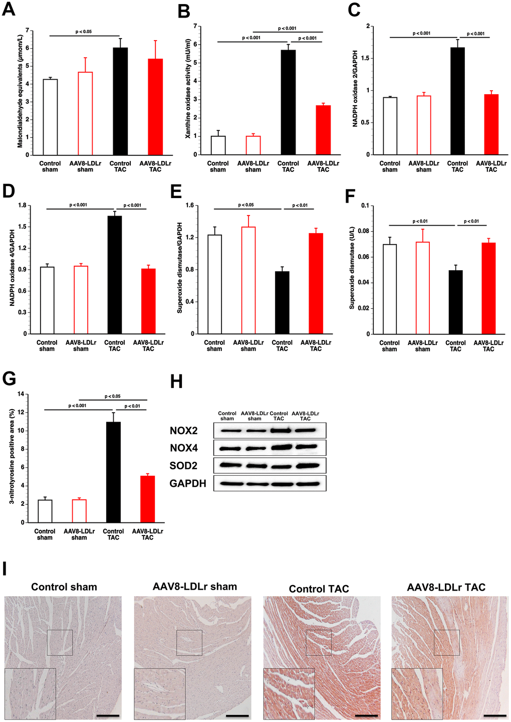 Cholesterol lowering gene therapy in TAC mice reduces pro-oxidative enzymes, increases anti-oxidant defence systems, and decreases nitro-oxidative stress in the myocardium. Bar graphs illustrating plasma TBARS expressed as plasma malondialdehyde equivalents (A), plasma xanthine oxidase activity (B), myocardial protein level of NADPH oxidase 2 (C), of NADPH oxidase 4 (D), and of superoxide dismutase (E), and plasma superoxide dismutase activity (F) (n=8 for each condition). Percentage of 3-nitrotyrosine-positive area in the myocardium in control sham (n=14), AAV8-LDLr sham (n=11), control TAC (n=25), and AAV8-LDLr TAC (n=11) mice 8 weeks after operation (G). Data are expressed as means ± SEM. Representative images of western blots are shown in panel h. Representative photomicrographs showing myocardial sections stained for 3-nitrotyrosine (I). Scale bar represents 100 μm. Insets show a 4x magnification of the boxed region.