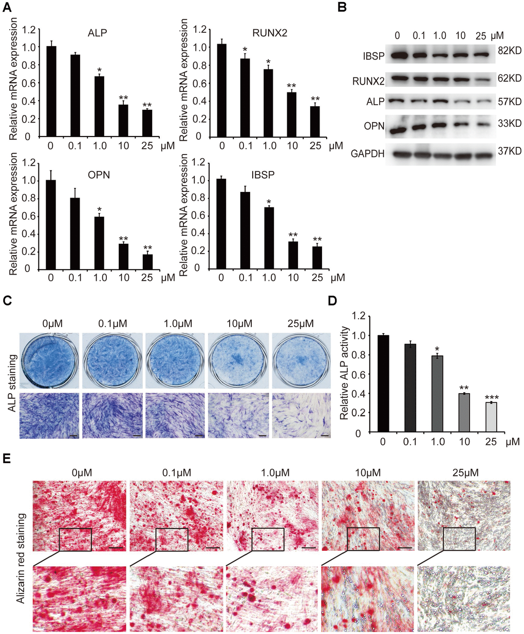 The effect of different concentrations of curcumin on osteogenic differentiation of hADSCs. (A) qRT-PCR detected the mRNA levels of osteogenic-related genes in curcumin- treated cells on day 6. (B) Western blot assays analysed the protein levels osteogenic related genes in curcumin-treated cells. (C, D) ALP staining and ALP activity analyses indicated early differentiation on day 6. (E) Alizarin red staining was performed to detect calcium salt deposits on day 12. Scale bars: 200 μm. Quantitative data are presented as the mean ± S.D. (n =3). *P