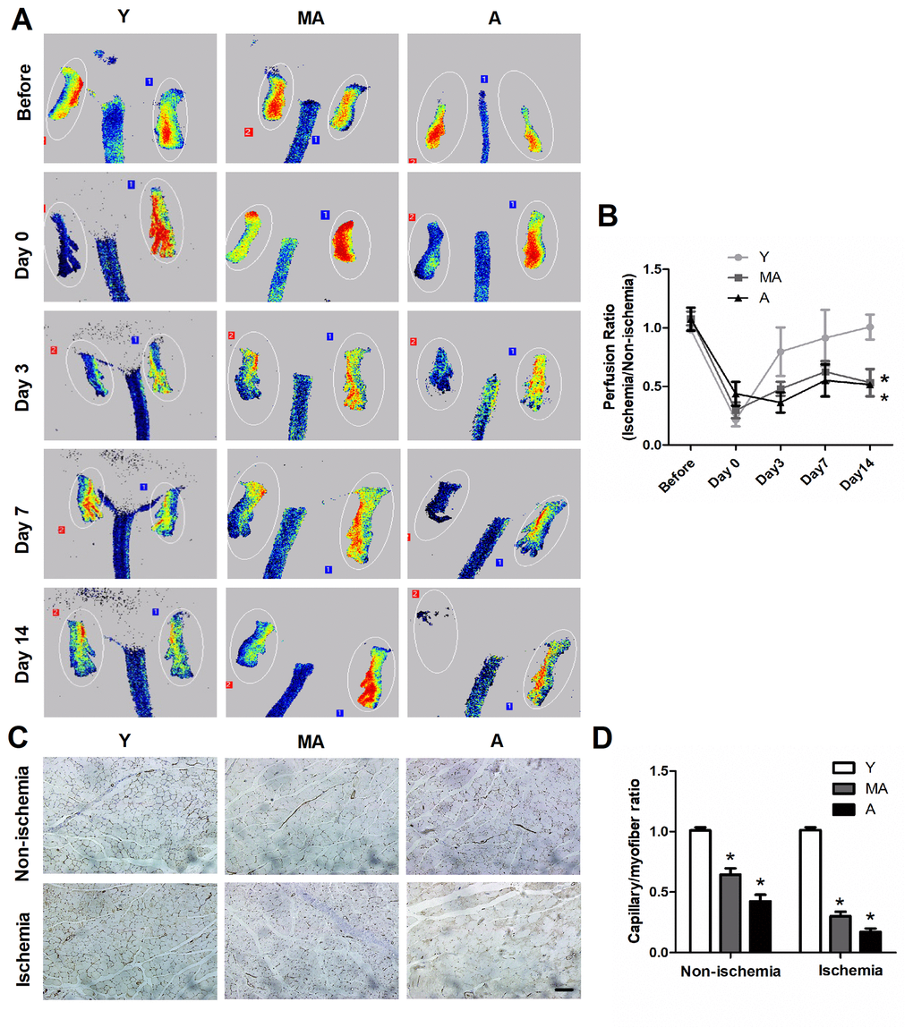 In vivo characterization of EPC angiogenesis. (A) Serial laser speckle blood flow imaging revealed that the ischemic hindlimbs of aged mice exhibited lower perfusion signals than those of younger mice. (B) The ratio of ischemic to normal blood flow decreased with aging. (C) On postoperative day 14, immunostaining was conducted to evaluate the capillaries in non-ischemic and ischemic thigh adductor muscles. (D) Quantitative analyses revealed that aging reduced the capillary density in both non-ischemic and ischemic muscles. *PC) 100 μm.