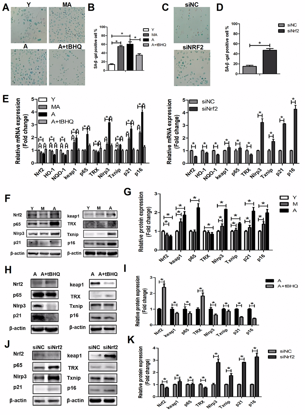 NRF2 suppressed EPC senescence. (A–D) β-galactosidase staining of Y, MA, A, A+tBHQ, siNC and siNrf2 EPCs. (E) Expression of Nrf2, Ho-1, Nqo-1, Keap1, p65, Trx, Nlrp3, Txnip, p21 and p16 mRNA in Y, MA, A, A+tBHQ, siNC and siNrf2 EPCs. (F–K) Representative Western blots and quantitative analysis of NRF2, KEAP1, p65, TRX, NLRP3, TXNIP, p21 and p16 levels in Y, MA, A, A+tBHQ, siNC and siNrf2 EPCs. *P