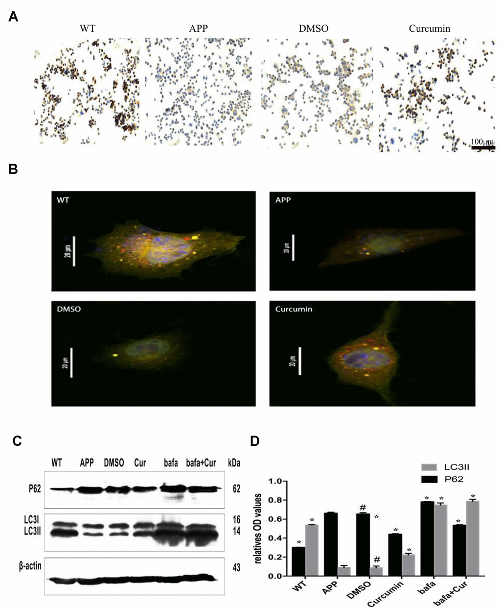 Curcumin enhanced autophagic flux and autophagosome-lysosome binding in N2a/APP695swe cells. (A) LAMP2 immunocytochemistry was used to detect the expression of lysosome in each group. Bar = 100 μm. (B) Fluorescent microscopy analysis of cells transiently overexpressing mRFP-GFP-LC3.Bar=20 μm. (C–D) Western blot analysis of P62 and LC3II in each group; Representative blot (A) and summary graph of densitometric analysis (D); The data represent as mean ± SEM of a typical series of 3 experiments (# P