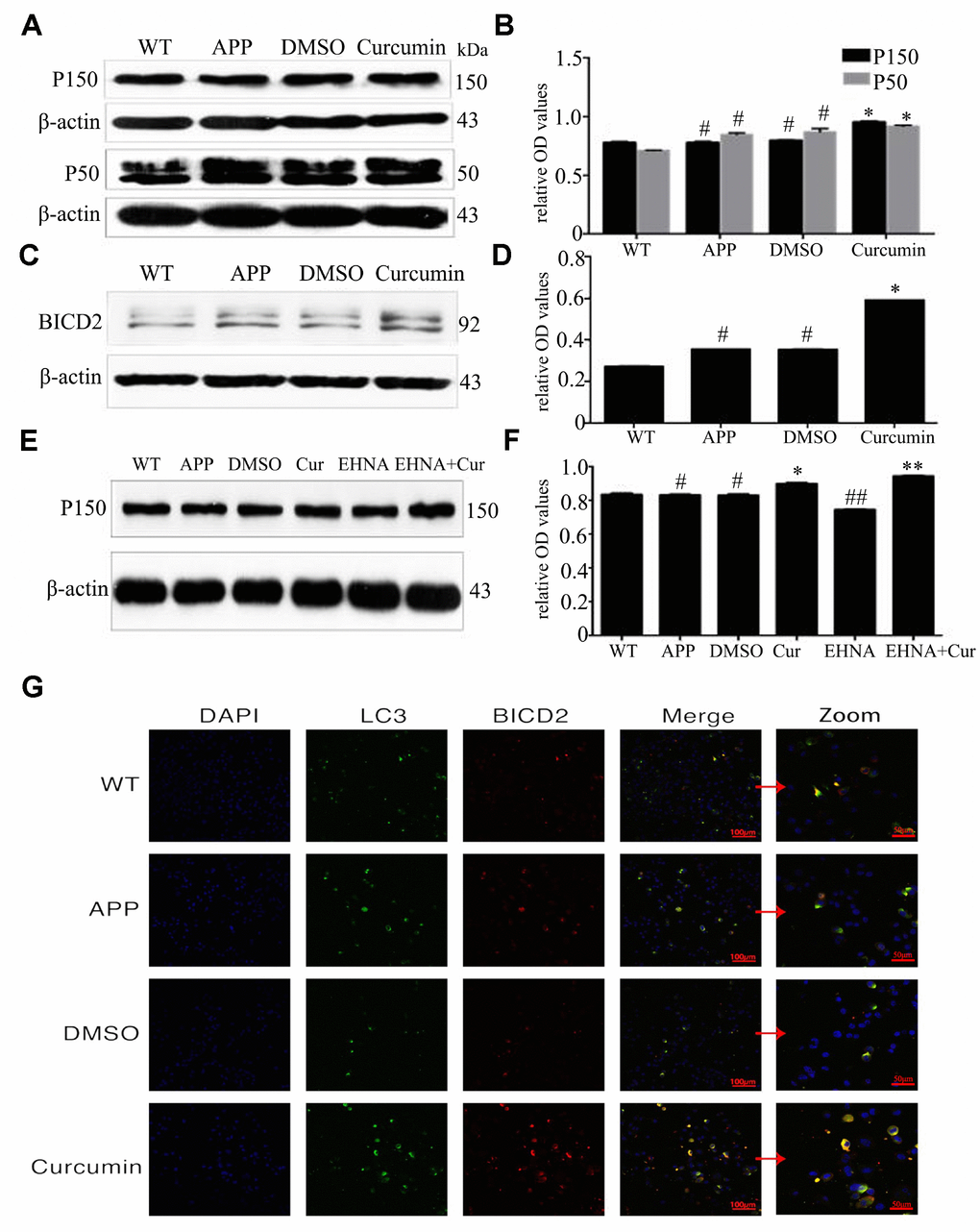 Curcumin promoted the expression of binding proteins dynactin (P150 and P50) and BICD2 (Bicaudal D, two-tailed D) in N2a/APP695swe cells. (A–D) Western blot analysis P150, P50 and BICD2 in each group; The data represent as mean ± SEM of a typical series of 3 experiments (* PE–F) Western blot analysis of P150 in each group with(out) dynein inhibitor EHNA; The data represent as mean ± SEM of a typical series of 3 experiments (* PG) Confocal fluorescence microscopy showed the expression of BICD2 and LC3 in each group. Bar=100/50 μm.