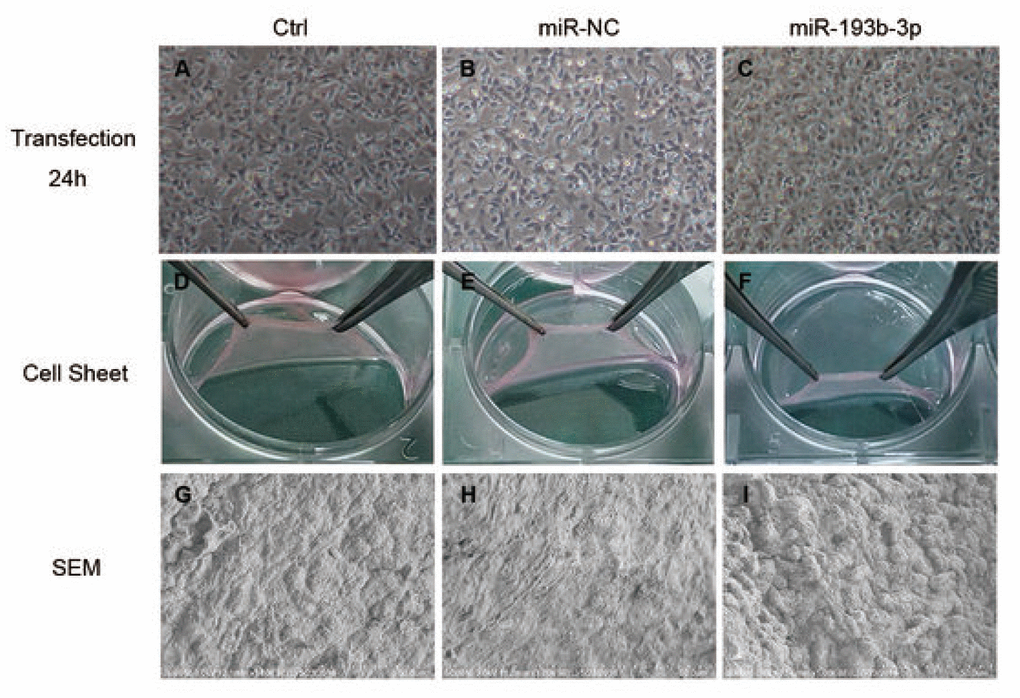 In vitro characterization of chondrocyte sheets (n=3). (A–C) Chondrocytes transfected for 24 hours in different groups (magnification x40). (D–F) The chondrocyte sheets formed after 8 weeks could be detached easily and completely. (G–I) SEM detection of chondrocyte sheets in different groups (magnification x1000; bar 50 μm).