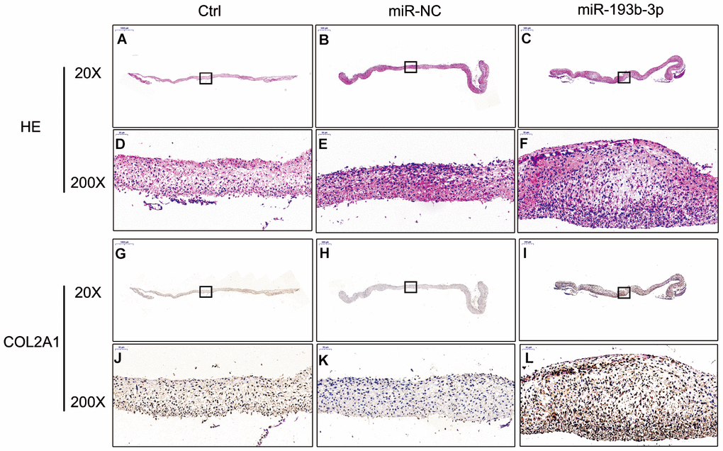 In vitro H&E staining and immunohistochemical assay of the chondrocyte sheets in different groups (n=3). (A–C) H&E staining magnification 20 times (bar 500 μm). (D–F) Zoom square magnification x200; bar 50 μm. (G–I) Immunohistochemical assay magnification 20 times (bar 500 μm). (J–L) Zoom square magnification x200; bar 50 μm.