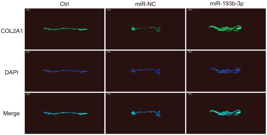 In vitro COL2A1 immunofluorescence staining of the chondrocyte sheets in different groups. Fluorescence microscopy imaging (bar 1000 μm) of the nucleus (blue) and COL2A1 (green) (n=3).