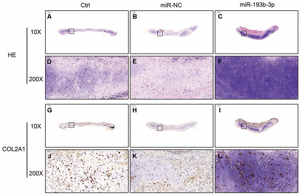 In vivo regenerative cartilage H&E staining and immunohistochemical assay in different groups (n=3). (A–C) H&E staining magnification 10 times (bar 1000 μm). (D–F) Zoom square magnification x200; bar 50 μm. (G–I) Immunohistochemical assay magnification 10 times (bar 1000 μm). (J–L) Zoom square magnification x200; bar 50 μm.