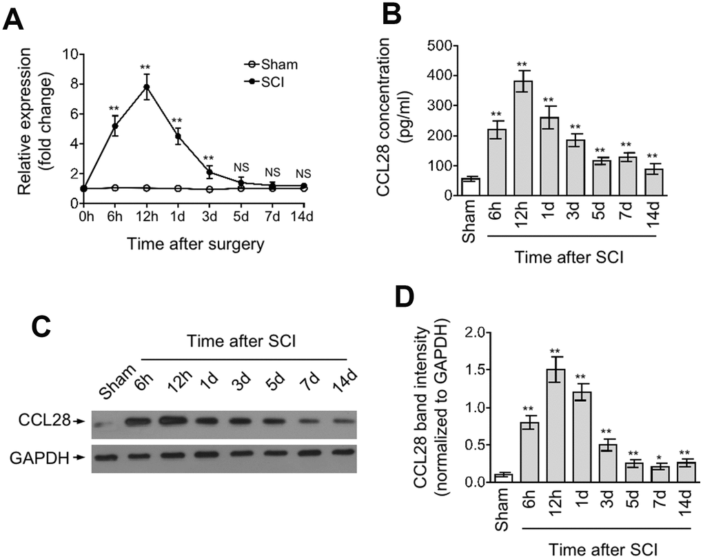 CCL28 is upregulated in the spinal cord after SCI. (A, D) qRT-PCR analysis of CCL28 mRNA level (A), ELISA analysis of CCL28 protein concentration (B), and Western blotting analysis of CCL28 protein expression (C) and band intensity analysis of CCL28 (D) in the spinal cord at different time points after sham or SCI surgery (n=5). GAPDH was used as a reference or loading control. Data are mean ± SD. Data were compared with sham group and statistical analysis was performed using Student’s t-test. **, P