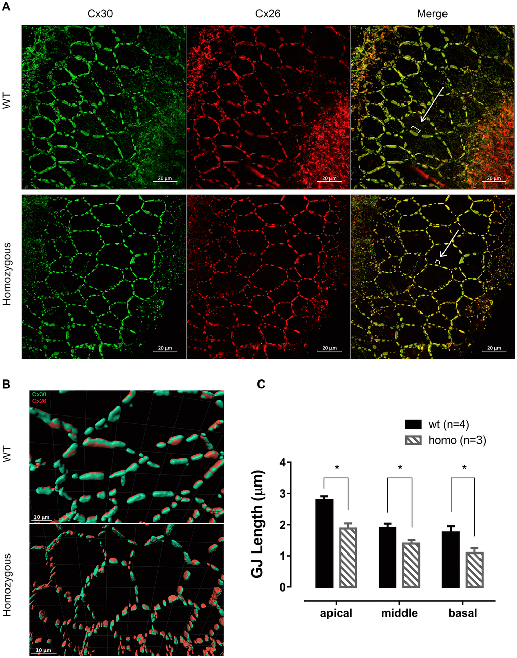 Connexin expression patterns in senior KI mice. (A) Representative confocal images of connexin 26 (Cx26, red), connexin 30 (Cx30, green) and merged images at the age of 60 weeks from apical turns of the basilar membrane. Cx26 and Cx30 were well expressed on the supporting cell membrane and mostly overlapped, forming a honeycomb-like labeling pattern. White brackets indicate the length of representative Cx plaques measured. Scale Bar, 20 μm. (B) Graphs of Imaris 3D-reconstructed images plotted at higher magnification. Cx26 (red) were accurately co-localized with Cx30 (green) in an adjacent parallel pattern. Cx plaques appeared shorter in homozygous supporting cells (Scale Bar, 10 μm). (C) Histograms presenting the average length of the CJ plaques, measured as shown in panel A, of both homozygous and wild-type mice (Mean + SEM). GJs were significantly shorter in homozygous mice in every turn (*P