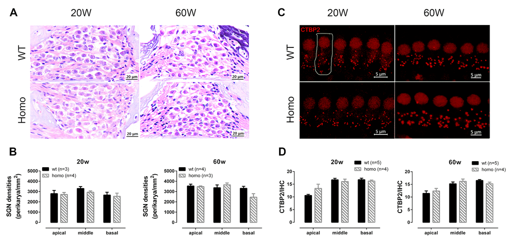 Spiral ganglion neuron (SGN) and inner hair cell (IHC) synapse count in KI mice at different ages. (A) Representative H&E staining images of SGNs at 20 and 60 week-old homozygous and wild-type mice (Scale Bar, 20 μm). (B) SGN density (Number of SGNs/area of Rosenthal’s canal) showing no significant difference between wild-type and homozygous mice at both time points (P>0.05 at both time points, two-way ANOVA followed by Bonferroni post-test). (C) Representative confocal images of IHC synapses. Dotted line outlines a single IHC (Scale Bar, 5 μm). (D) The numbers of CTBP2 puncta per IHC at both 20 and 60 weeks old showing no significant difference between two genotype groups (P>0.05 at both age groups, two-way ANOVA followed by Bonferroni post-test).