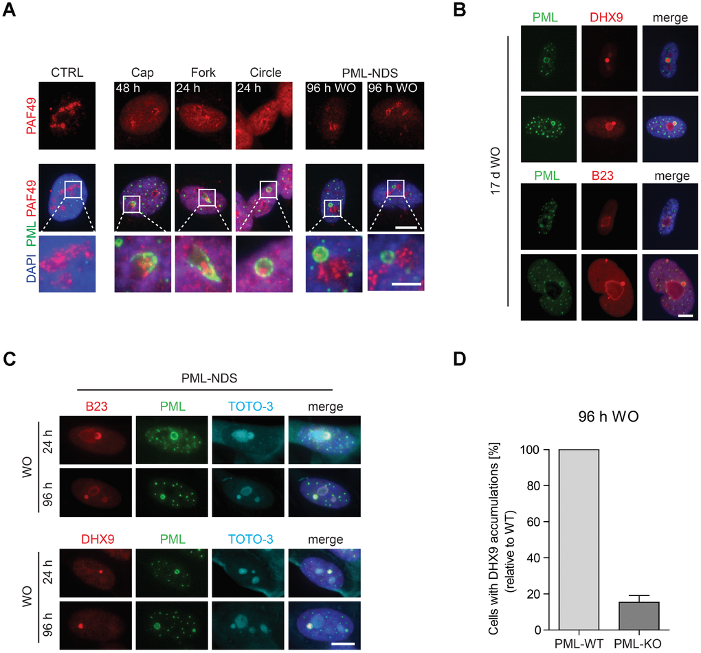 The association of specific subtypes of PNAs with different functional states of nucleoli. (A) The activity of RNAP I, evaluated as relocalization (segregation) of RNAP I subunit PAF49 and the presence of specific forms of PNAs were visualized by wide-field immunofluorescence microscopy of PAF49 (red) and PML (green) in RPE-1hTERT during different time-points of doxorubicin-treatment (0.75 μM) and its removal (WO). The insets show selected nucleoli with different states of RNAP I. Bars, 10 μm for whole cells and 4 μm for insets. (B) Long-term persistence (17 days after doxorubicin removal) of PML-NDS marked by PML (green) with accumulations of nucleolar proteins DHX9 and B23 (both in red). Bar, 10 μm. (C) Accumulation of B23 and DHX9 inside PML-NDS was visualized by immunostaining with respective antibodies (accumulated proteins – red, PML – green). Nuclei (A–C) and nucleoli (C) were visualized by DAPI (blue) and TOTO-3 (cyan), respectively. The images were captured with 63×/1.4 objective. Bar, 10 μm. (D) RPE-1hTERT PML-WT and PML-KO cells were treated with 0.75 μM doxorubicin for 48 hours; after that doxorubicin was removed and the cells were further cultured. 96 hours after doxorubicin washout the cells were fixed, stained with antibodies against DHX9 and PML and imaged with the Olympus ScanR microscope. The occurrence of cells with DHX9 accumulations were analyzed by the ScanR analysis software. The relative occurrence of cells with accumulations of DHX9 is shown. Two biological replicates were evaluated. Results are presented as a mean ± s.d.