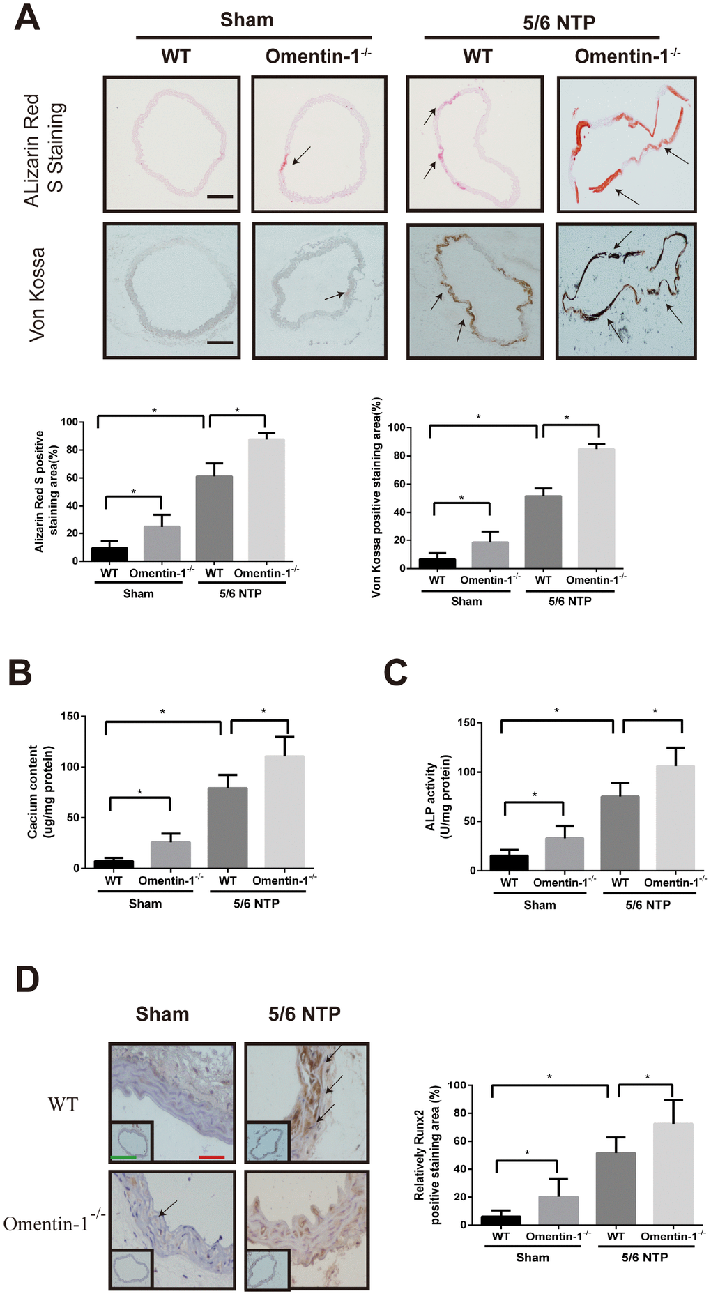 Omentin-1 deficient enhanced artery calcification in 5/6 NTP-induced mice. Six-week-old omentin-1-/- mice and their littermates were subjected to 5/6-nephrectomy or sham operation following by high phosphate diet (0.9% Pi) for indicated time. (A) Sections from the thoracic aorta of sham operation mice and 5/6 NTP mice were determined by Alizarin Red S staining and Von Kossa staining. Representative microscopic pictures were shown (upper panel) and quantity of positive staining area in the thoracic aorta were analyzed (lower panel). Scale bar 200 μm (n=6/group). (B) Calcium content of the thoracic aorta was measured in different group mice. (C). The ALP activity of the thoracic aorta was measured by an ALP kit, normalized to the total tissue protein contents. (D) Immunohistochemistry of Runx2 in the mouse thoracic aorta. Representative microscopic pictures were shown in the upper panel and quantity of positive staining area in the thoracic aorta were shown in the lower panel. Scale bar 20 μm (Red) and 500 μm (Green). Results are represented by mean ± SD with 6 replicates for each group. Significance was analyzed by two-way ANOVA with the Tukey’s HSD post hoc analysis. (*p 