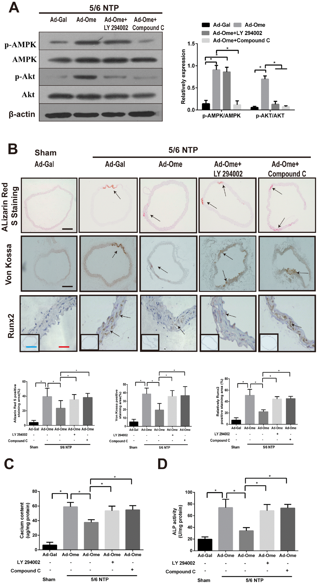 Omentin-1 alleviates arterial calcification in 5/6 NTP-induced mice. Six-week-old Male mice were subjected to 5/6-nephrectomy or sham operation following by high phosphate diet (0.9% Pi) for indicated time and then the adenovirus-encoding omentin-1 (Ad-Ome) or control adenovirus-encoding β-galactosidase (Ad-Gal) were injected into the tail vein of mice one time per week for four weeks. (n=6 for each group). (A) Expression of p-AMPK and p-Akt in the aorta of 5/6NTP mice treated with LY 294002 or Compound C were analyzed by western blot. (B) Von Kossa-stained, Alizarin Red S-stained and Runx2-stained sections from the thoracic aorta were tested to identify calcification level of artery. Representative microscopic pictures were shown in the upper panel and quantity of positive staining area in the thoracic aorta was shown in the lower panel. Scare bar 20 μm (Red), 200 μm (Black) and 500 μm (Green). (C) Calcium content of the thoracic aorta was measured in different group mice. (D) The ALP activity was measured by an ALP kit, normalized to the total tissue protein contents. Results are represented by mean ± SD with 6 replicates for each group. Significance was analyzed by two-way ANOVA with the Tukey’s HSD post hoc analysis. (*p 